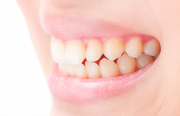 歯の健康とかみ合わせの関係